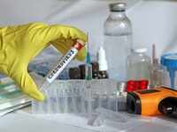 <i class="tbold">coronavirus</i>