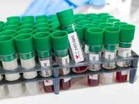 What is <i class="tbold">serum institute of india</i>'s role in vaccine development?