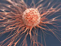 How to prevent <i class="tbold">anal cancer</i>