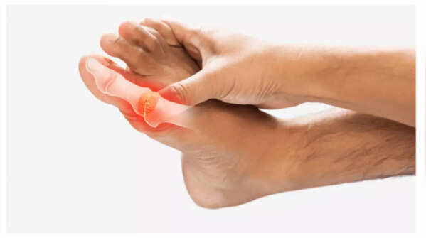 5 high uric acid symptoms that you should not ignore, and how it affects your kidneys