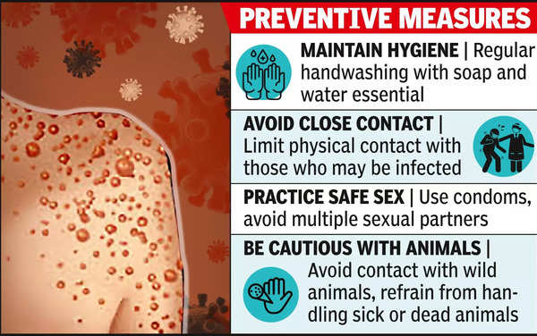 Monkeypox Monkeypox Outbreak Nagpur Health Expert Urges Vigilance