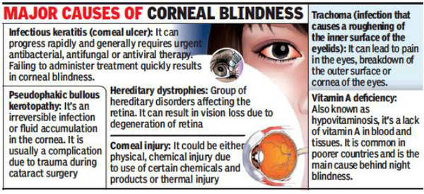 Cornea Corneal Transplant Facility May Be Available Free Of Cost In