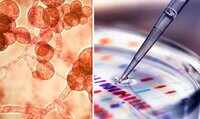 Mystery drug resistant fungal infection new health threat across the globe