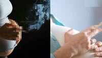 Quitting smoking during pregnancy lowers risk of preterm births