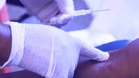 First human blood transfusion performed in 1818