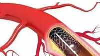 Government all set to identify a list of 'essential medical devices'