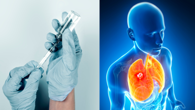 Medical Breakthrough: 1st lung cancer vaccine BNT116 clinical trials launched, vaccine based on Covid mRNA