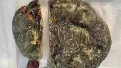 Thane crime branch arrest man for selling whale vomit worth Rs 5 crore