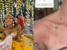 Priyanka Chopra's 'Bhabhi' Neelam Upadhyaya suffers from allergic reaction on skin after Haldi ceremony