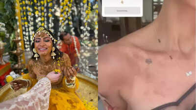 Priyanka Chopra's 'Bhabhi' Neelam Upadhyaya suffers from allergic reaction on skin after Haldi ceremony