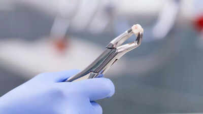 Doctors restored a man’s sight by placing his tooth in his eye; this is how they did it