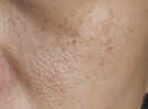 Face packs that can close your open pores