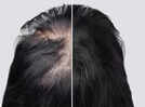 How to use Castor Oil to regrow hair on a bald spot