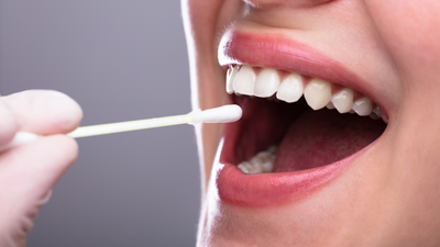 How healthy is your Saliva? The Ayurvedic Perspective on Oral Health