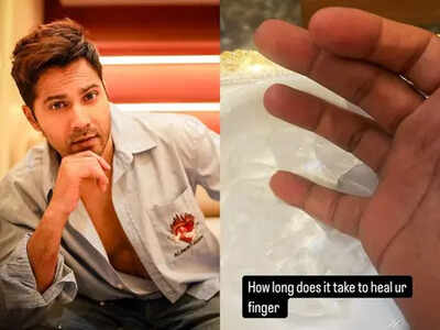 Varun Dhawan gets a 'work injury', asks 'how long it takes to heal'