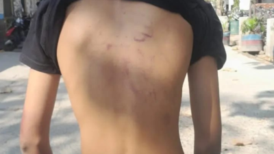 14-year-old boy thrashed by Uttarakhand cops, probe ordered