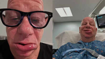 Comedian Jeff Ross rushed to the ER after an allergic reaction to ice cream: Could it happen to you?