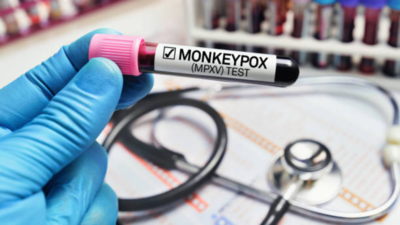 Highly contagious Mpox Clade 1b detected in the UK: Key symptoms, preventive measures to know