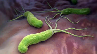This simple stomach bug can cause stomach cancer if left untreated