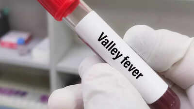 Valley fever turning into an epidemic in California: Scientists find a strong link to dogs