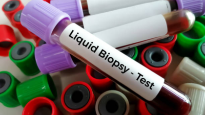 Could liquid biopsies change the way we detect and monitor cancer?