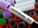 Could liquid biopsies change the way we detect and monitor cancer?