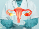 What makes ovarian cancer the 'silent killer' and how can women protect themselves?