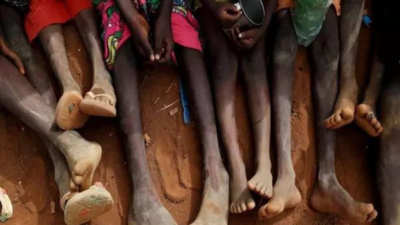 Over 3k Palestinian children admitted for acute malnutrition, UN report states