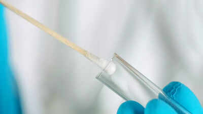 Viral: Swab tests reveal hidden bacteria on flight surfaces like windows