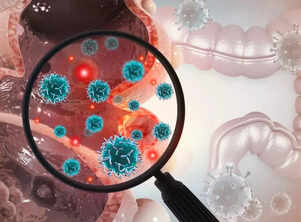 Childhood exposure to THIS bacteria is the reason behind rising cases of colorectal cancer in youngsters