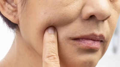 Ozempic face: The unexpected side effect of using the popular weight loss drug (and how to avoid it)