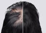 How to grow hair on bald patches using Amla