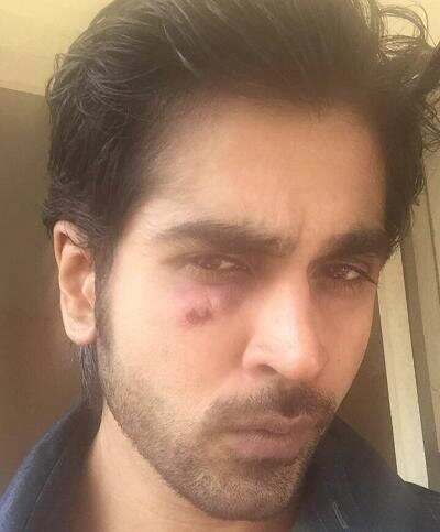Rajeev Pillai gets hurt while playing cricket
