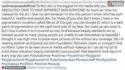 Bigg Boss Tamil fame Vaishnavi Prasad flaunts her no make up look, spreads awareness on Nevus of Ota 