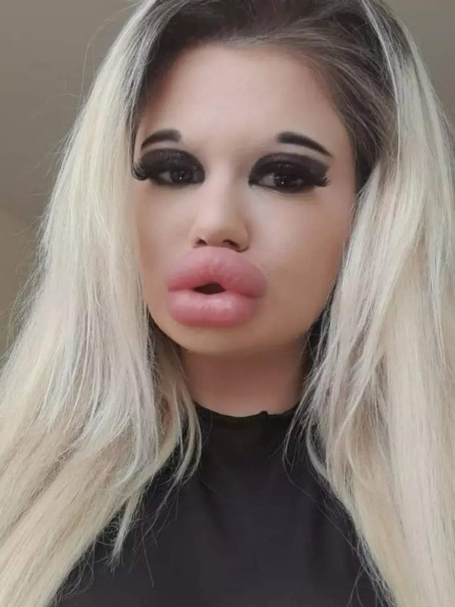 Meet Andrea Ivanova Woman With World S Biggest Lips Times Of India