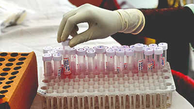 Active Covid cases cross 1,400 mark in Karnataka