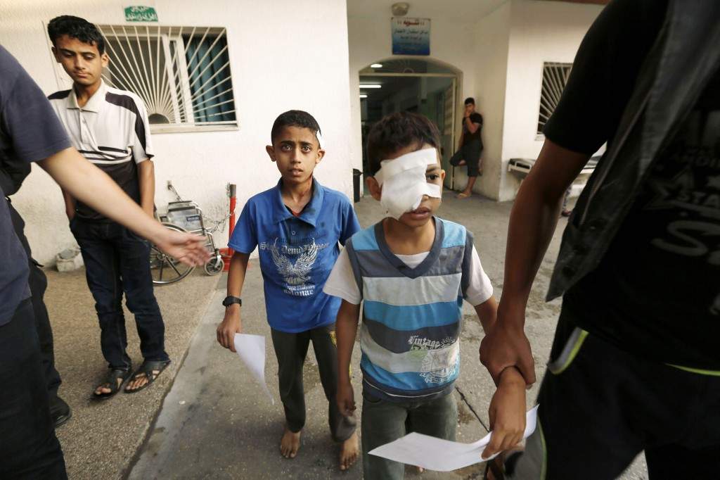 Two wounded Palestinian children taking shelter at a UN school receive treatment at the Kamal Edwan hospital in Beit Lahia in the northern Gaza Strip. (AFP PHOTO/ MOHAMMED ABED)