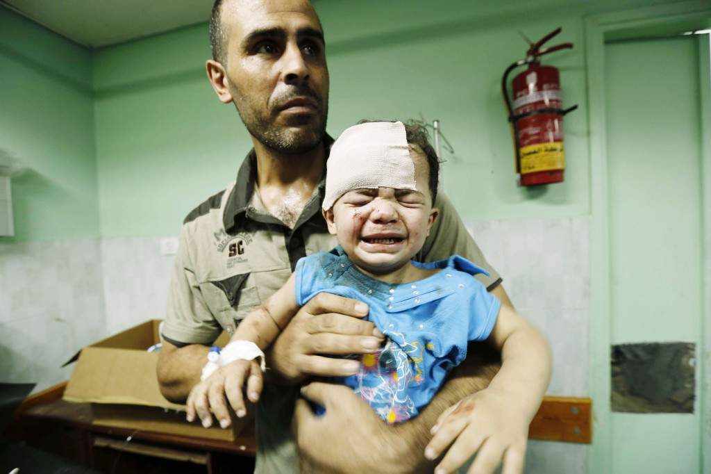 A Palestinian child receives treatment at Kamal Edwan hospital in Beit Lahia. (AFP PHOTO / MOHAMMED ABED)