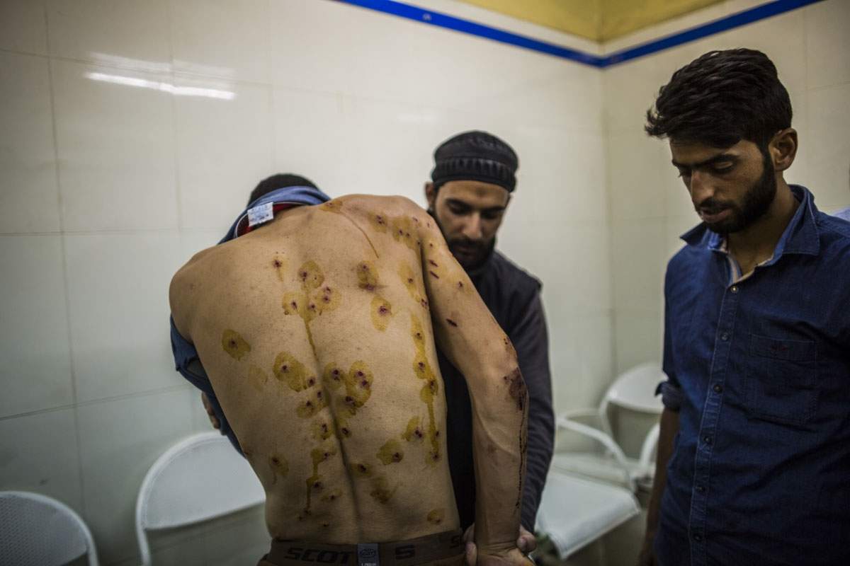A victim shows off his pellet wounds. August, 2016. (AFP / Rebecca Conway)