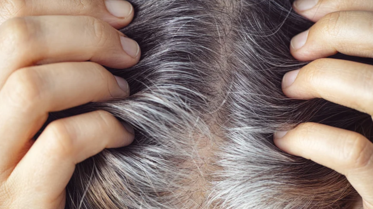 How to avoid premature greying