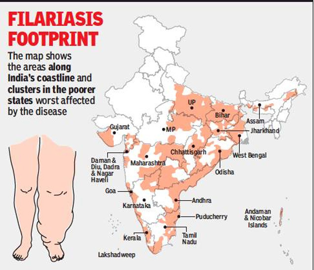 filariasis in india: The epidemic you don’t know about | India News