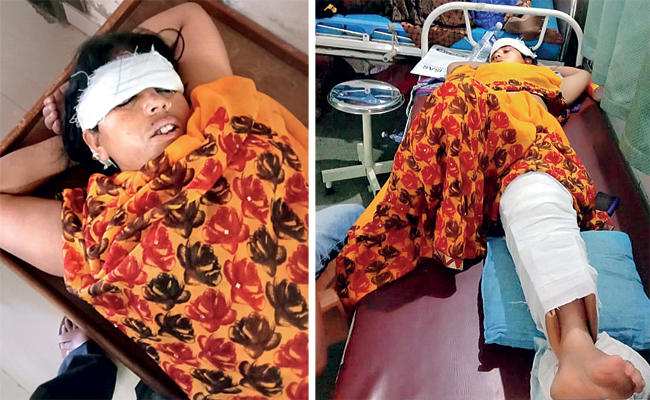 Seema Dohre at a private hospital in Lonavala