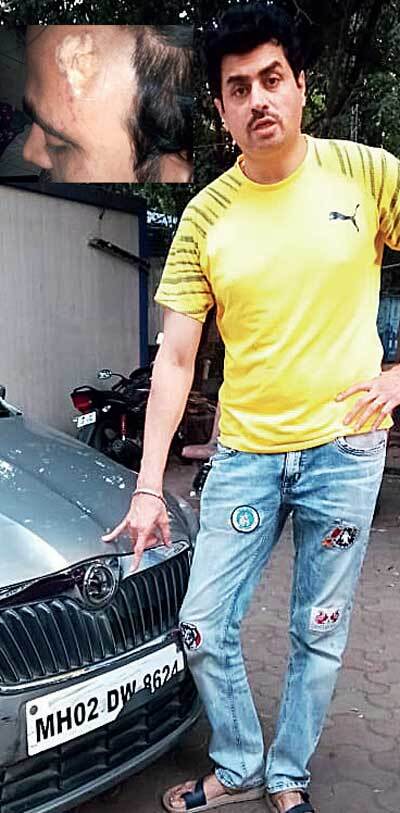 Pritam Singh's car was damaged; (top left) woman's friend was injured in the head