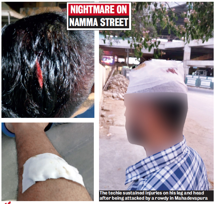 The techie sustained injuries on his leg and head after being attacked by a rowdy in Mahadevapura