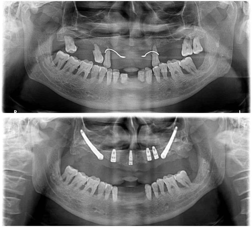 Balaji Dental & Craniofacial Hospital: Breakthrough in Maxillofacial ...