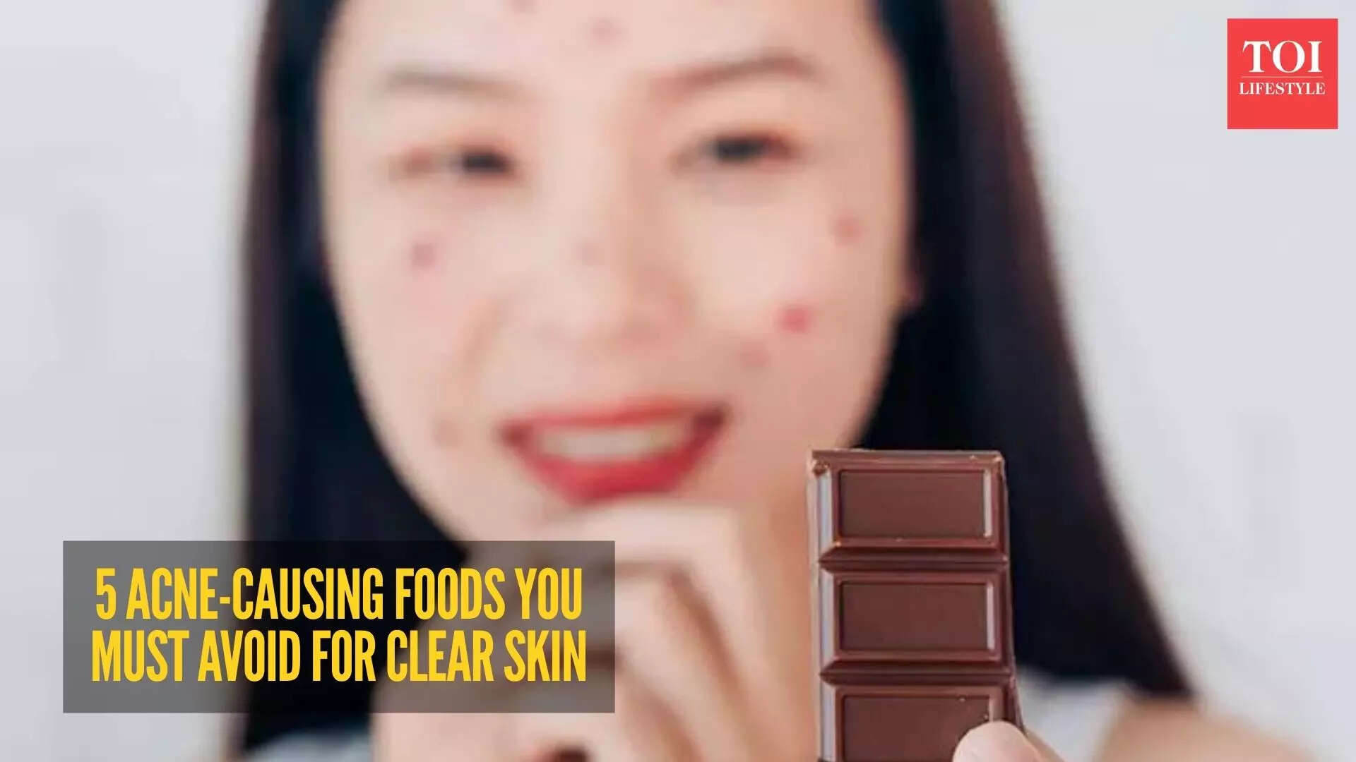 5 everyday foods responsible for triggering acne and breakouts