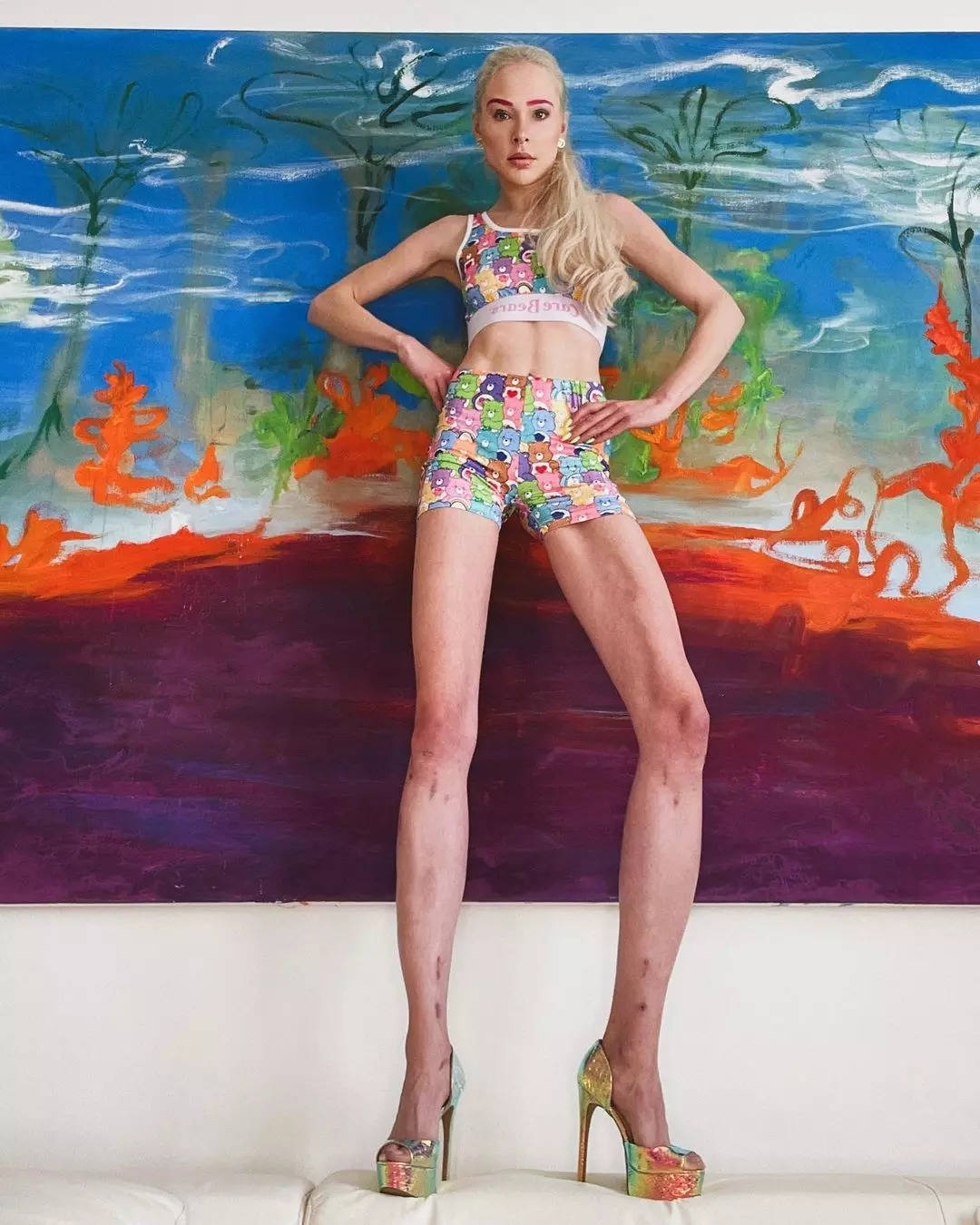 ​Theresia Fischer spent a crore to increase the length of her legs​