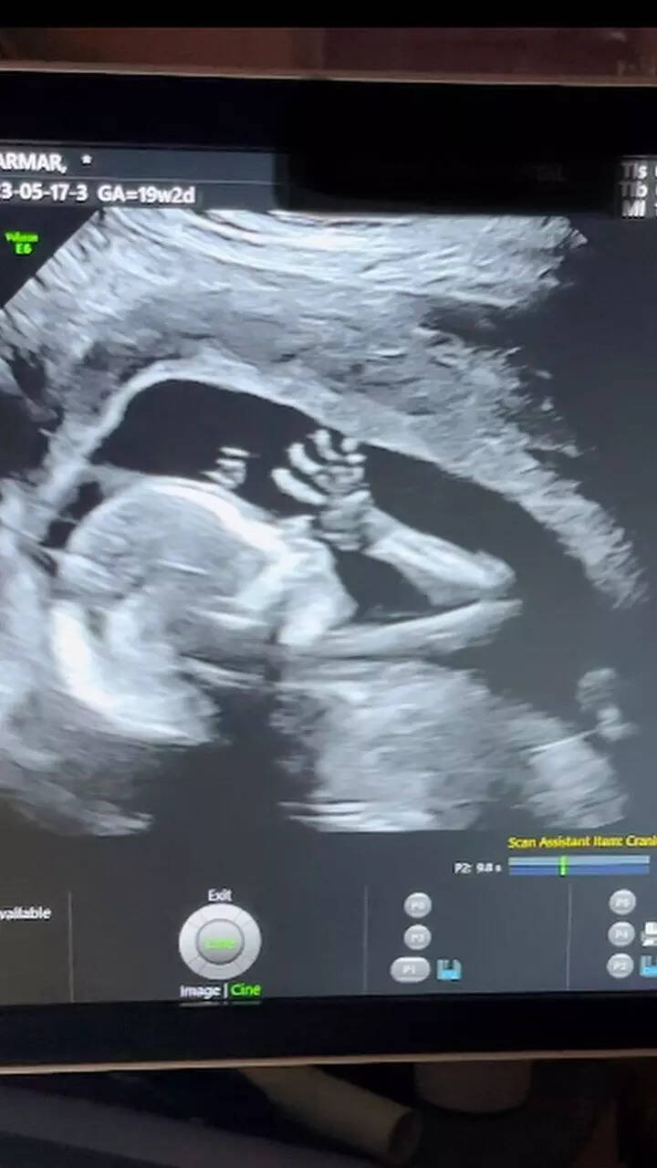 Disha Announces Pregnancy