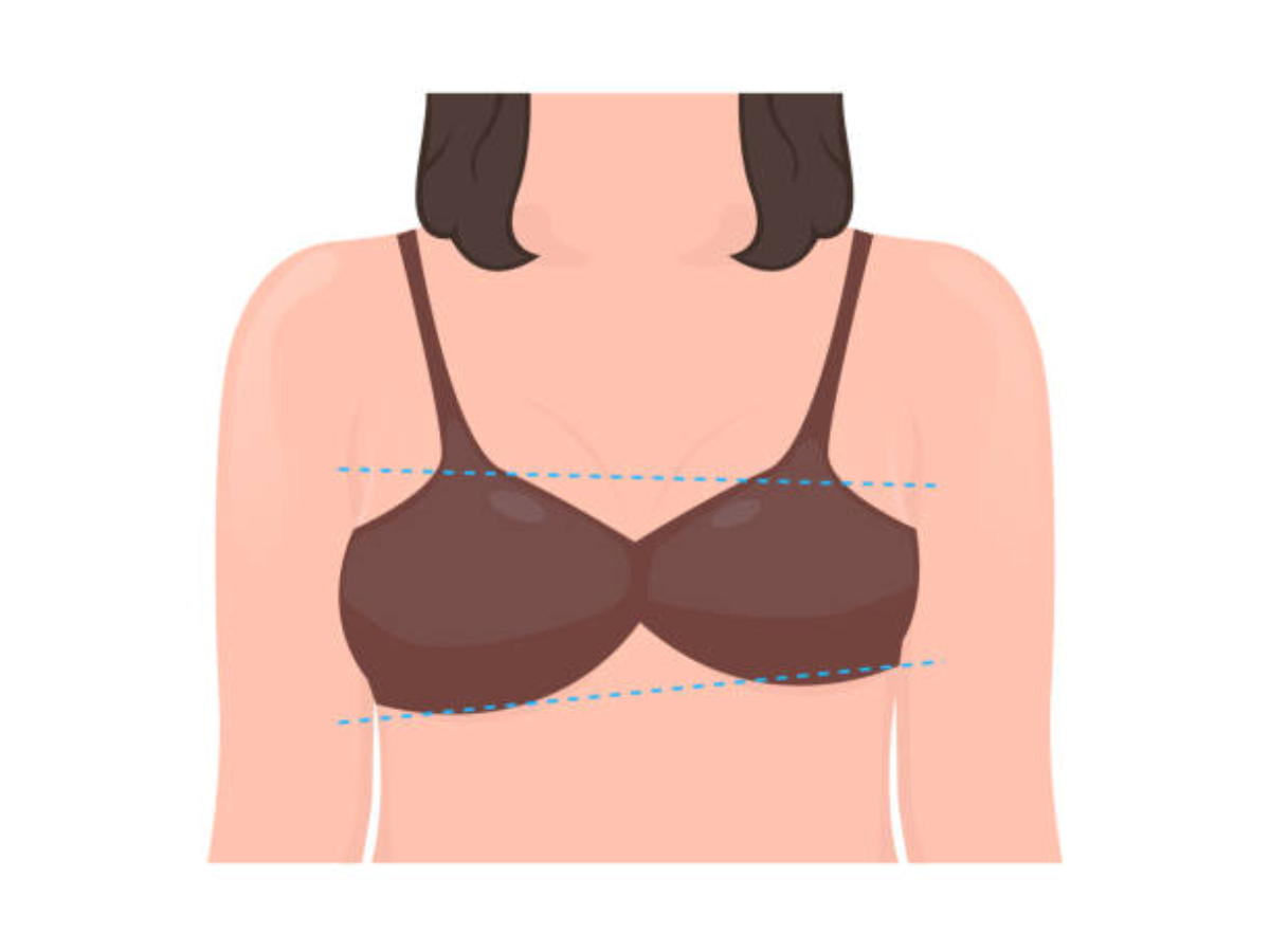 Is it normal if my one breast is slightly bigger than the other?
