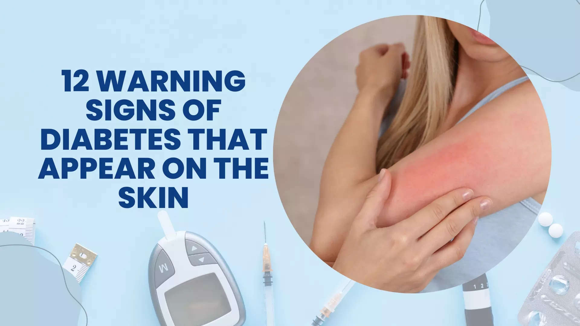 12 Warning Signs Of Diabetes That Appear On The Skin